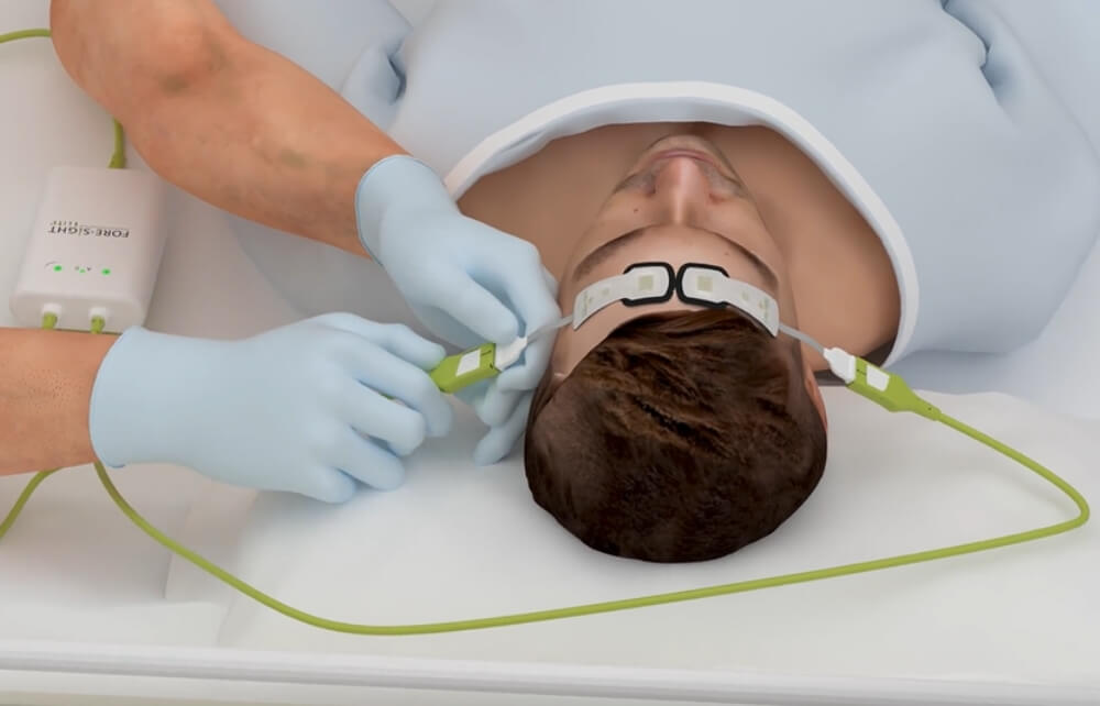 ForeSight tissue oximetry setup video